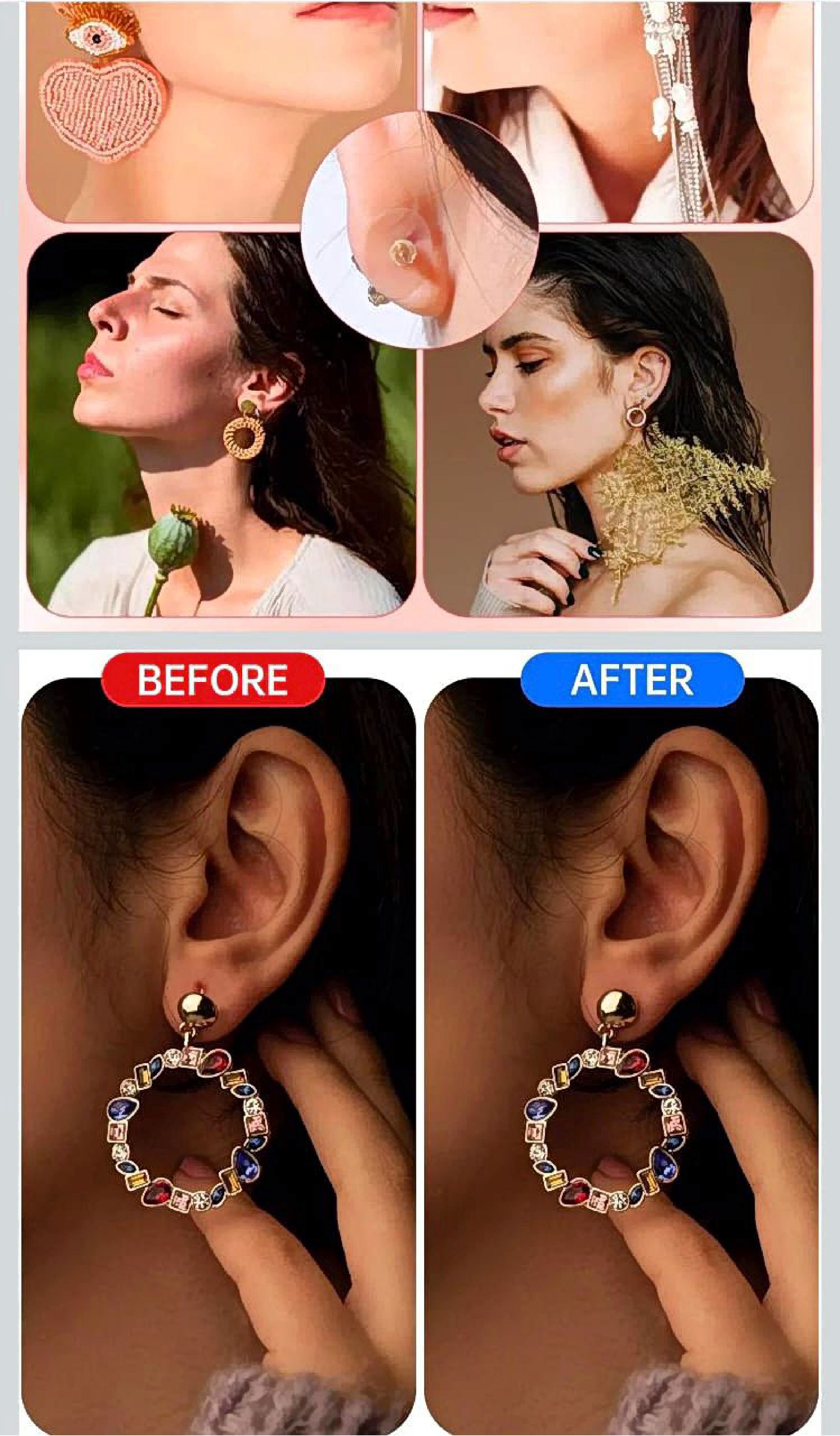 Ear Patch Set (100 PCS)